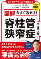 図解今すぐ治せる！脊柱管狭窄症 痛み取りのカリスマ治療家がわかりやすく教える症状改善への最短経路