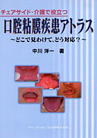 チェアサイド・介護で役立つ口腔粘膜疾患アトラス どこで見わけて、どう対応？