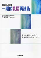 乳がん術後一期的乳房再建術 乳がん術式に応じた乳房再建のテクニック