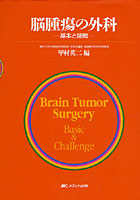 脳腫瘍の外科 基本と挑戦