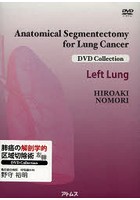 肺癌の解剖学的区域切除術 左肺 DVD