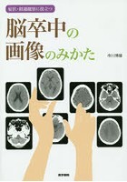 脳卒中の画像のみかた 症状・経過観察に役立つ