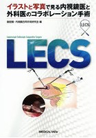 LECS イラストと写真で見る内視鏡医と外科医のコラボレーション手術