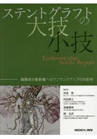 ステントグラフトの大技・小技 胸腹部大動脈瘤へのワンランクアップの対処術