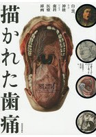 描かれた歯痛 白と黒、および神経からなる歯科医療挿画