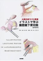 大阪日赤ラパロ教室イラストで学ぶ腹腔鏡下胃切除