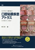 チェアサイド・介護で役立つ口腔粘膜疾患アトラス どこで見わけて、どう対応？