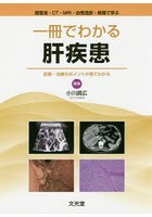 一冊でわかる肝疾患 超音波・CT・MRI・血管造影・病理で学ぶ 診断・治療のポイントが見てわかる