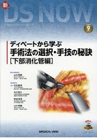 ディベートから学ぶ手術法の選択・手技の秘訣 下部消化管編