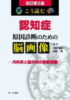 こう読む認知症原因診断のための脳画像 内科系と脳外科の診断流儀