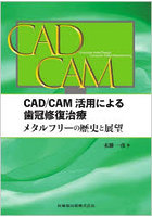 CAD/CAM活用による歯冠修復治療 メタルフリーの歴史と展望