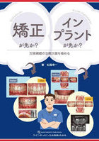 矯正が先か？インプラントが先か？ 欠損補綴の治療計画を極める