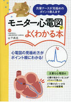 モニター心電図がよくわかる本 先輩ナースが見極めのポイント教えます