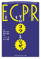 ECPR:そのコツとなぜ？