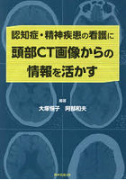 認知症・精神疾患の看護に頭部CT画像からの情報を活かす