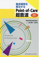 Point-of-Care超音波
